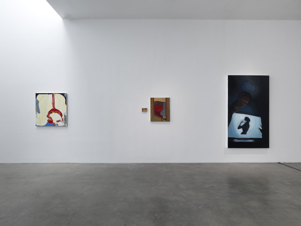  Gladstone Gallery 