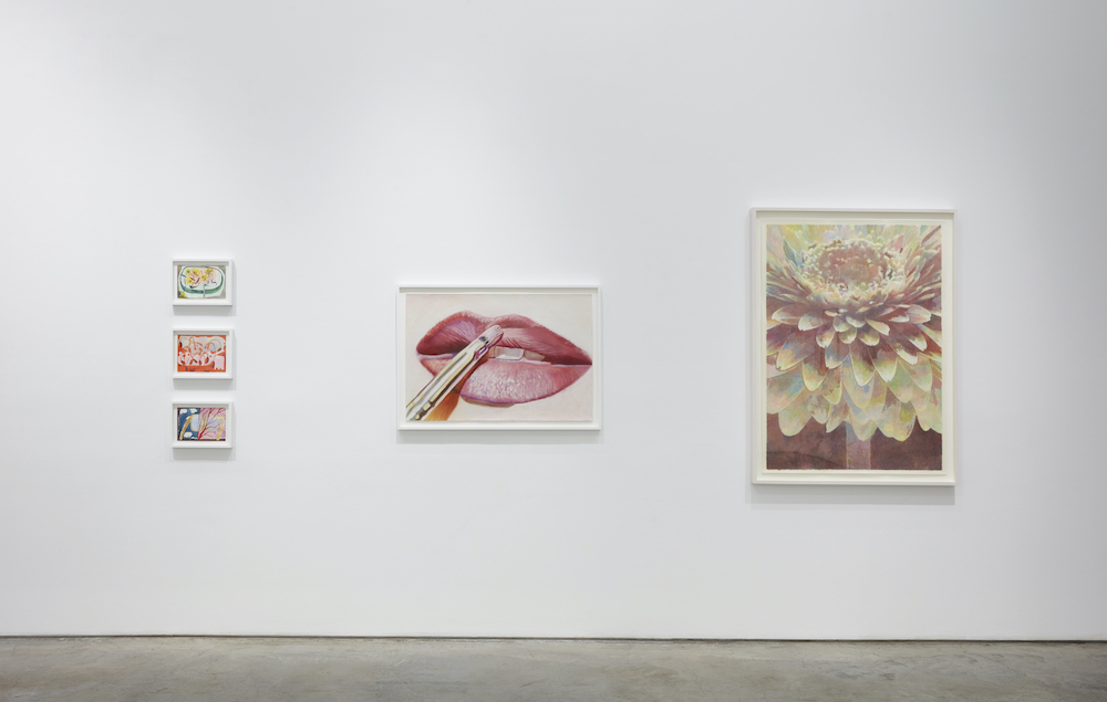  Boesky Gallery 