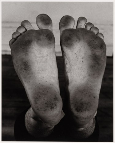 Peter Hujar, Neil Greenberg’s Feet, ca. 1986 , Galerie Buchholz