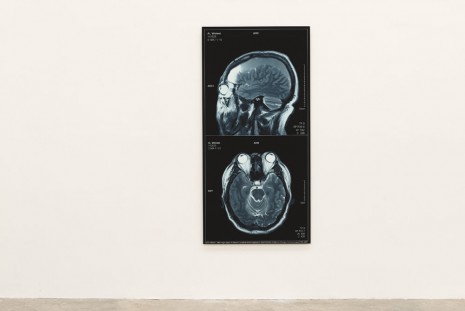 Ai Weiwei, Brain Inflation, 2009, Galleria Continua