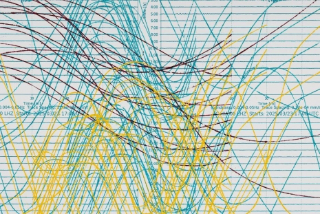 Allora & Calzadilla, Pulse, 2025, Galerie Chantal Crousel