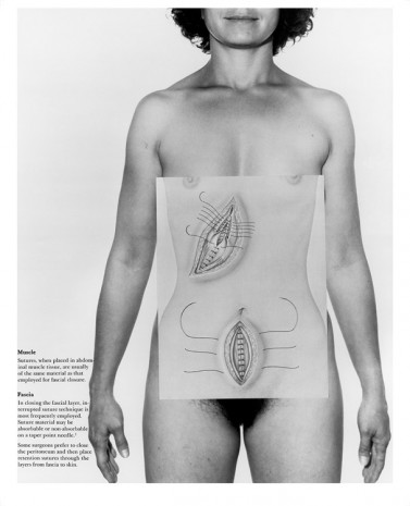 Donna-Lee Phillips, The Abdomen, from the series Anatomical Insights, 1978, printed 2016, Cherry and Martin