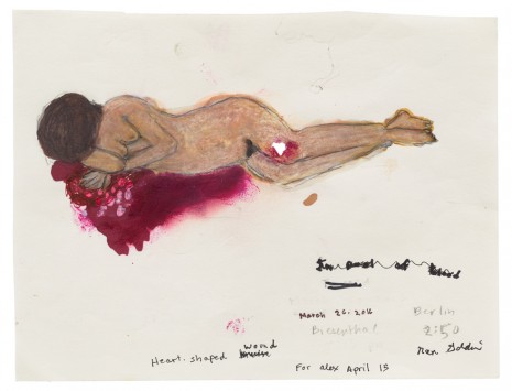 Nan Goldin, Heart shaped wound, Biesenthal, March 2016, 2016 , Matthew Marks Gallery