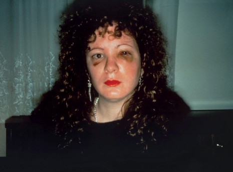Nan Goldin, Nan one month after being battered, 1984 , Matthew Marks Gallery