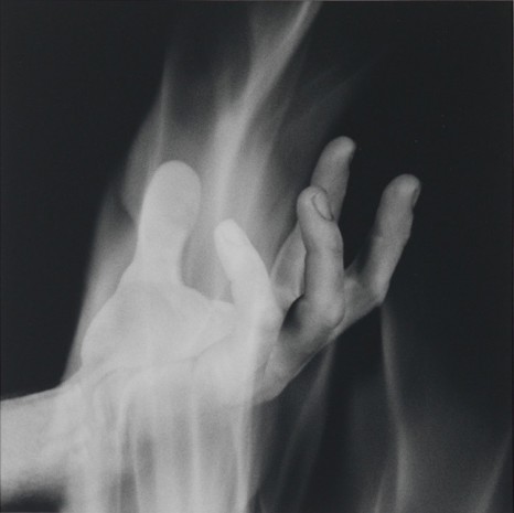 Robert Mapplethorpe, Hand in Fire, 1985 , Gladstone Gallery